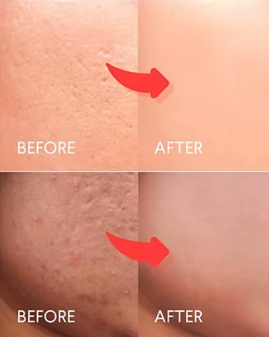 Sonicscrub - Ultrasonic Skin Exfoliator